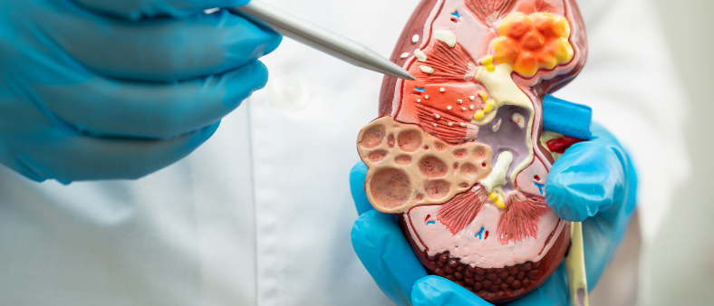 nephrology Nephrology Treatment in India